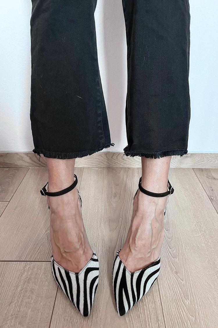 Kimberly Benn | Zebra Print Pumps With Ankle Strap